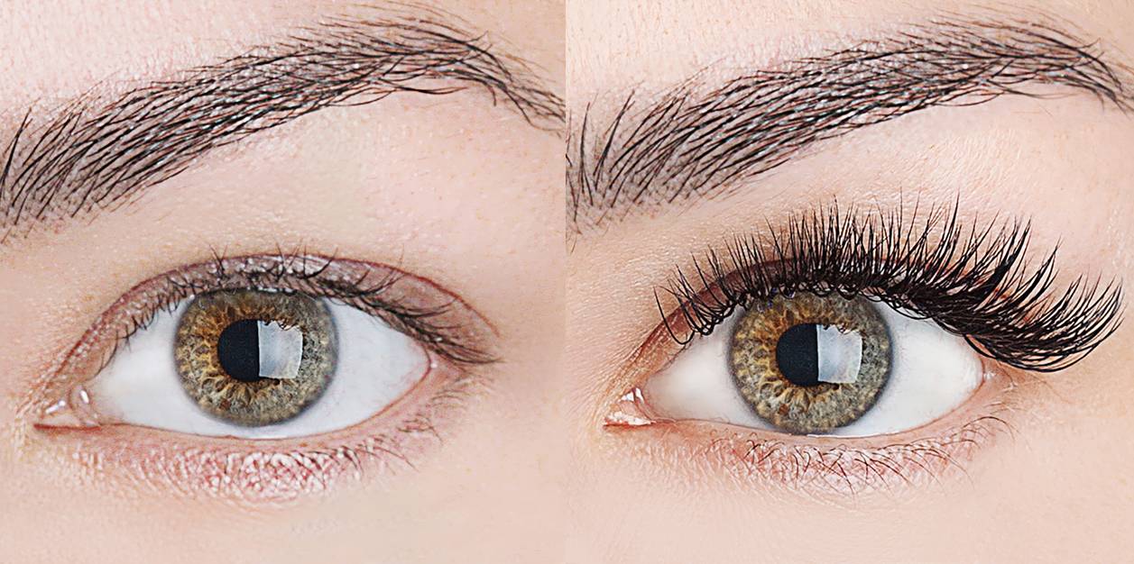 xtreme-lashes-before-and-after-jo-mousselli-eyelash-extensions-eyelashes-sudbury-ontario-skin-medispa-1