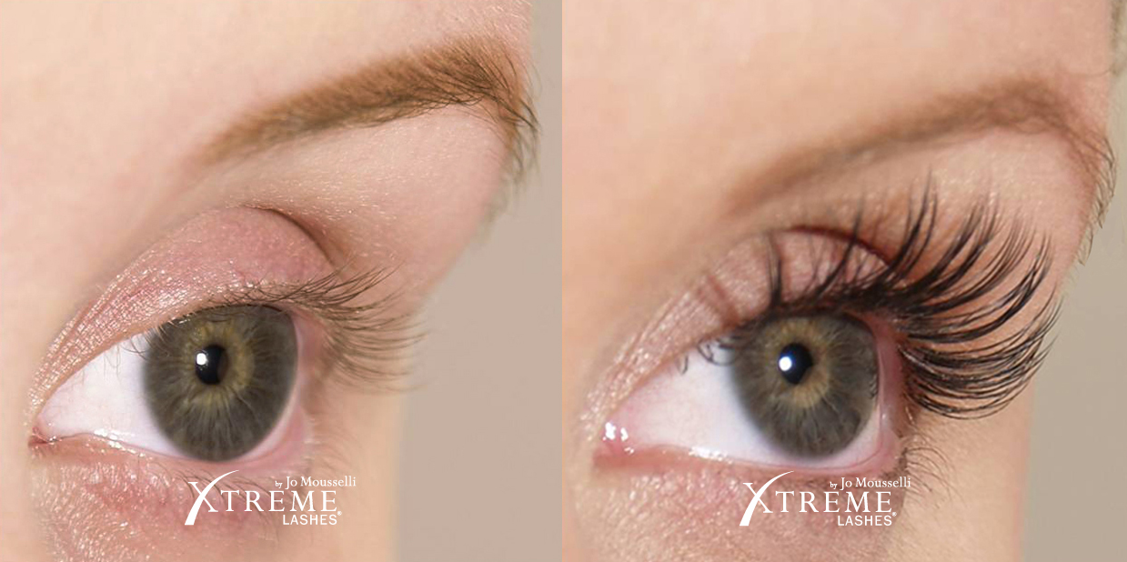 xtreme-lashes-before-and-after-jo-mousselli-eyelash-extensions-eyelashes-sudbury-ontario-skin-medispa