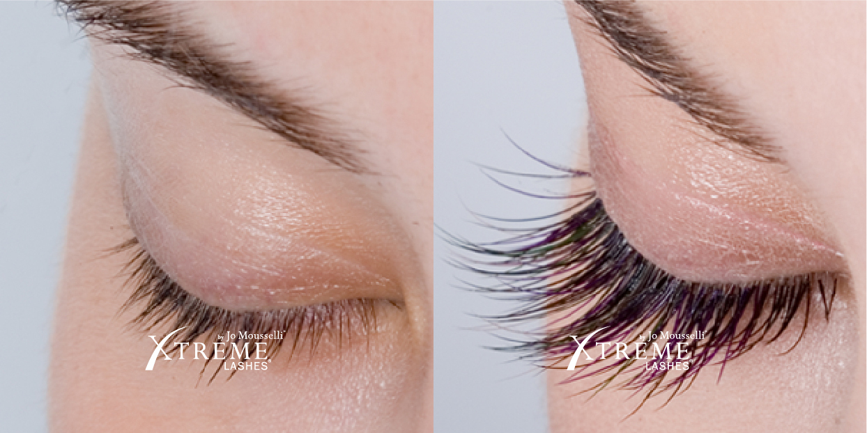 xtreme-lashes-before-and-after-jo-mousselli-eyelash-extensions-eyelashes-sudbury-ontario-skin-medispa-3